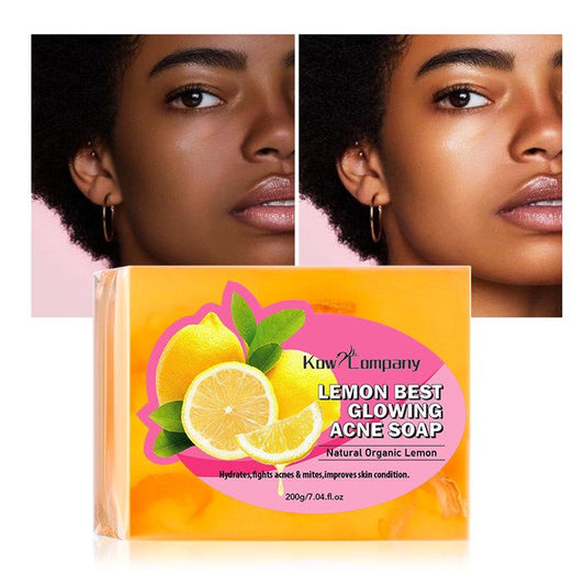 Lemon Glowing Acne Soap Bar